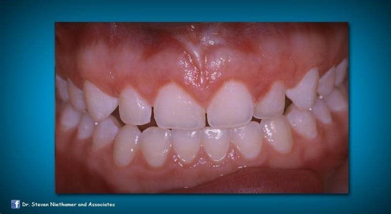 The Pediatric Dentists - Teeth